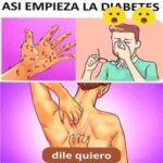 Descubre las 7 Señales que Indican que Tienes Demasiado Azúcar en Sangre