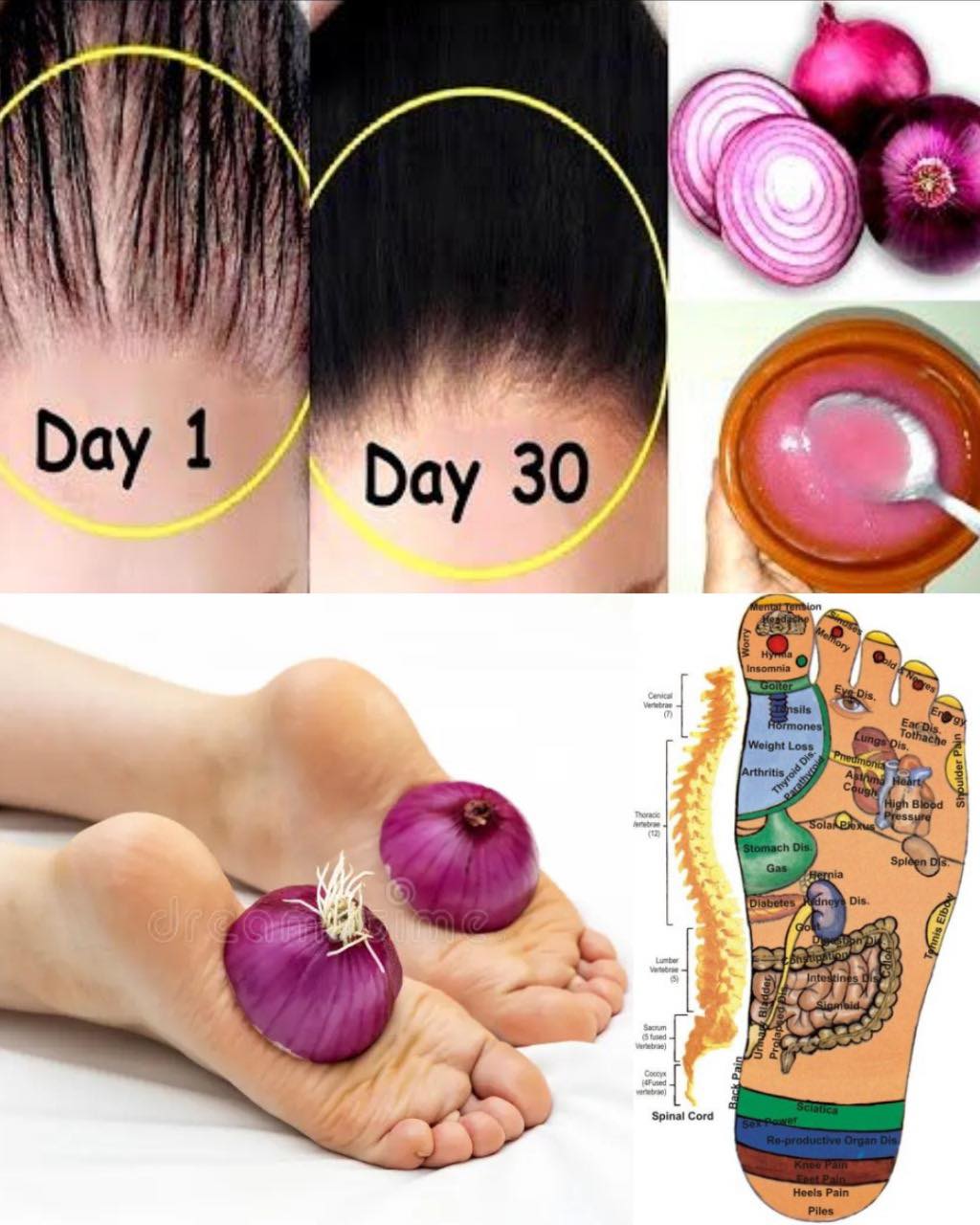 Cebolla como remedio natural