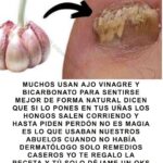 ¿Hongos en las Uñas? Descubre Cómo Combatirlos con Remedios Naturales