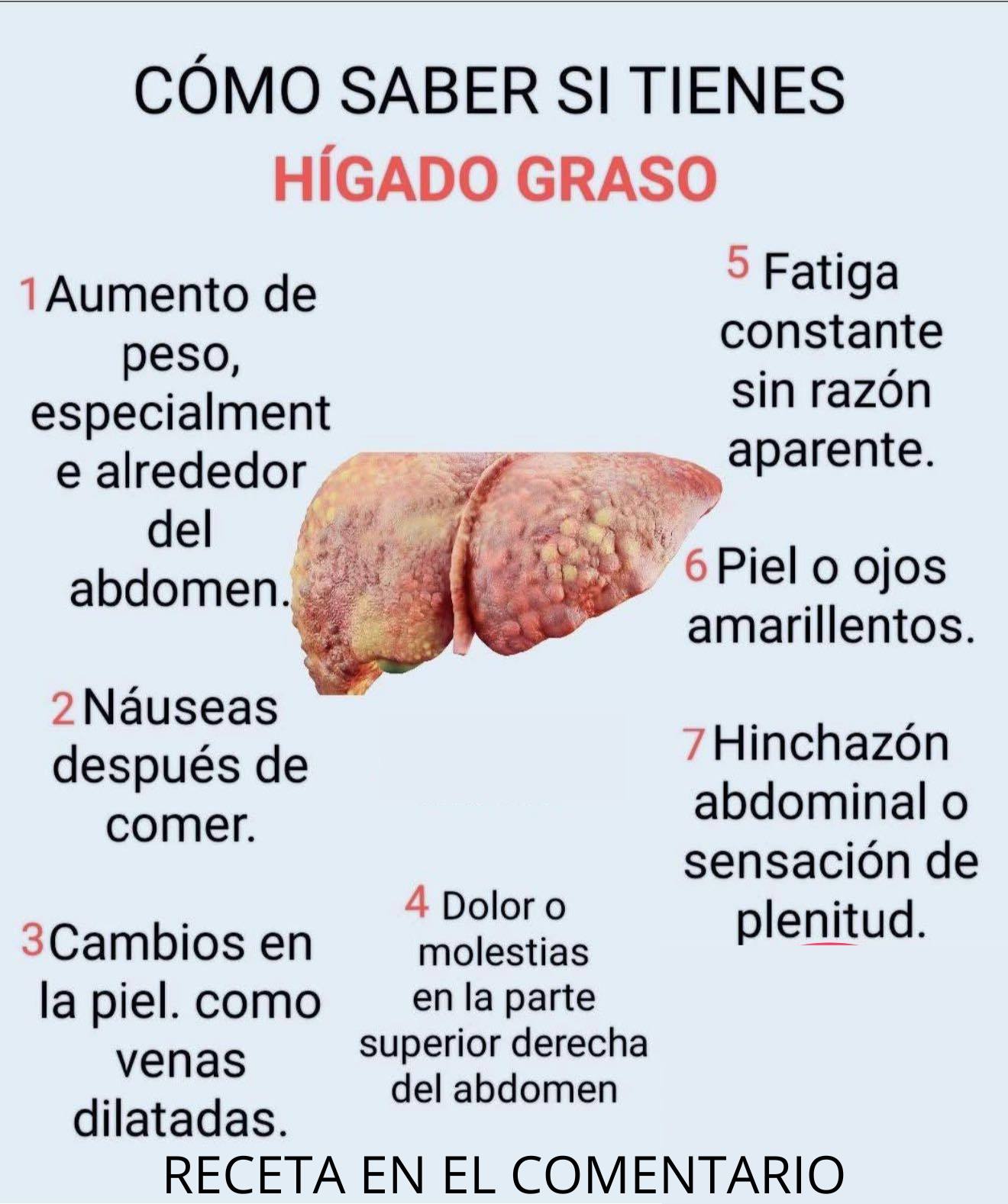 Cómo identificar el hígado graso