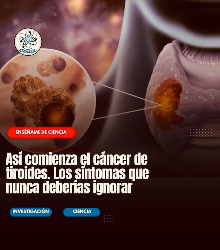 Cáncer de Tiroides