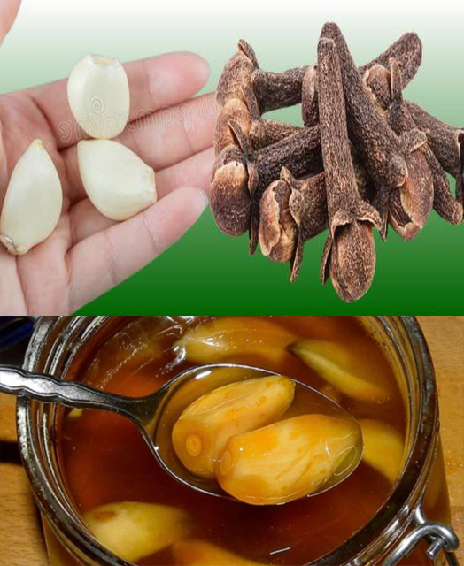 Ajo, miel y clavos como remedios naturales