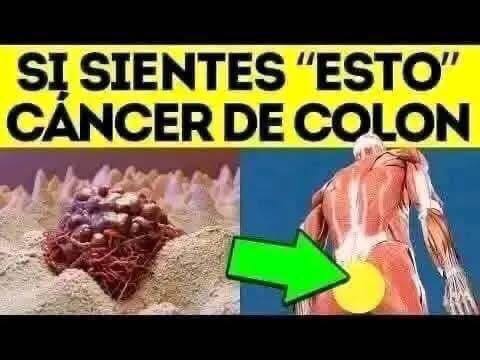Síntomas del Cáncer de Colon