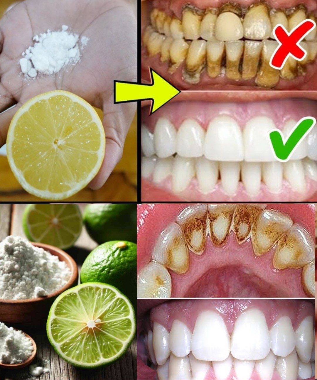 Remedios caseros para blanquear dientes con jengibre y limón
