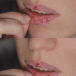 ¿Labios Agrietados? Descubre las Causas y Soluciones Naturales