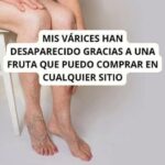 Descubre los Sorprendentes Beneficios de una Fruta Común para Combatir las Várices