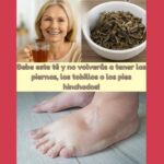 Té Natural para Combatir la Hinchazón en Piernas, Tobillos y Pies