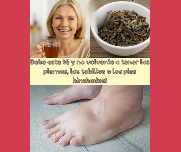 Té natural para reducir la hinchazón