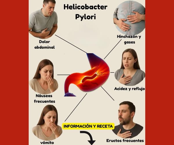 Síntomas de Helicobacter Pylori