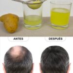 El Poder Oculto de la Papa: Remedio Natural para un Cabello Fuerte y Radiante