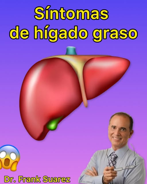 Síntomas de hígado graso