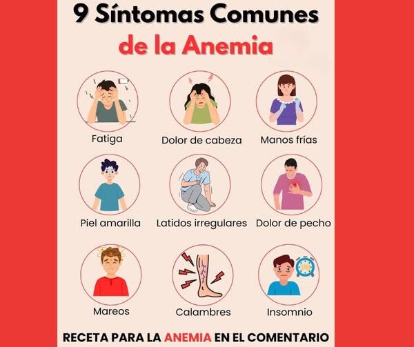 Síntomas comunes de la anemia