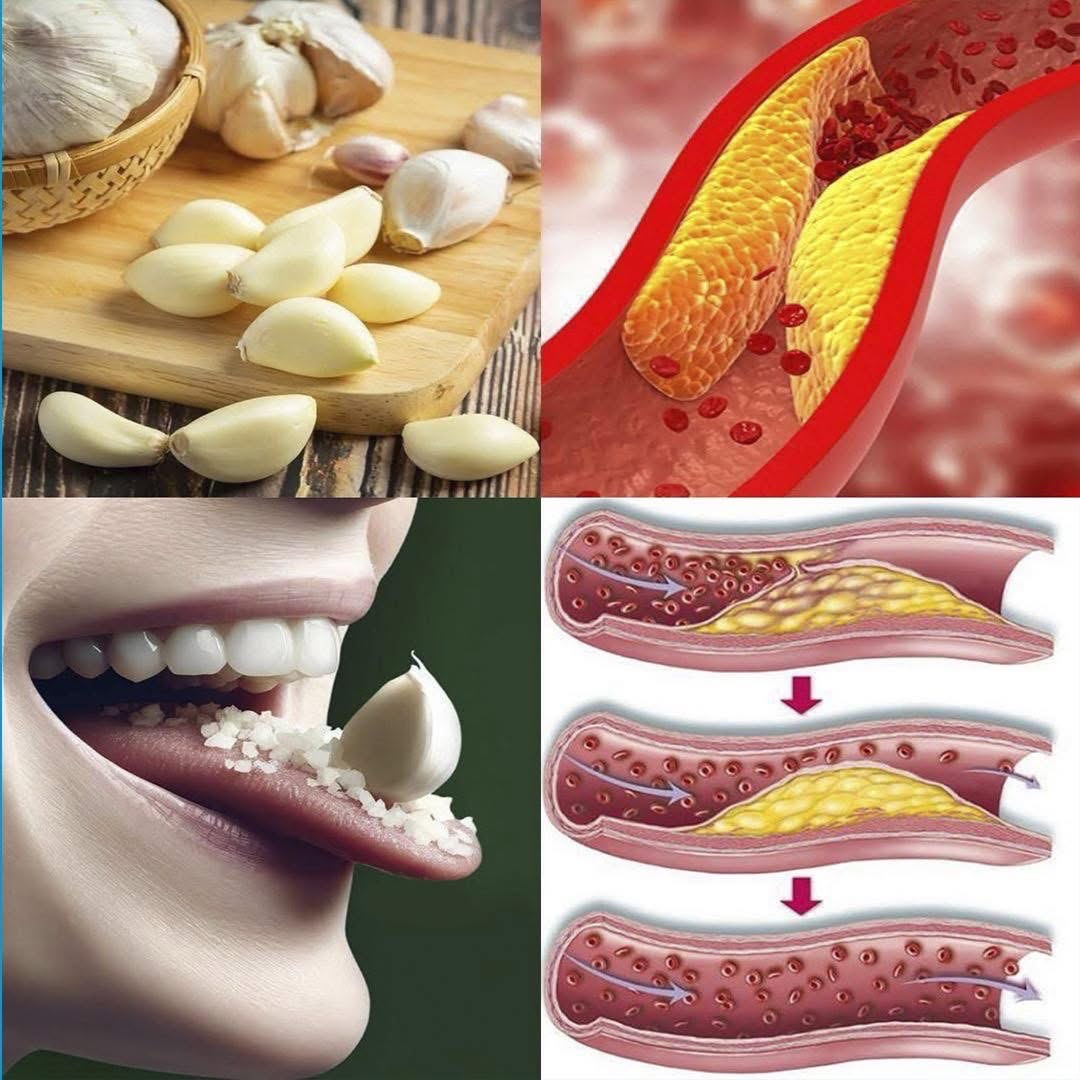 Beneficios del Ajo para la Salud