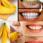 ¡Ilumina Tu Sonrisa en 2 Minutos con Cáscara de Plátano! Un Remedio Natural para el Blanqueamiento Dental