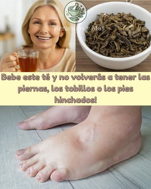 Té para reducir la hinchazón en piernas