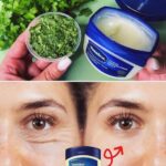 Combate Arrugas y Acné con el Remedio Casero de Vaselina y Perejil