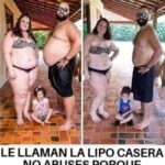 Transformaciones con Solo Dos Ingredientes: El Secreto de La Lipo Casera