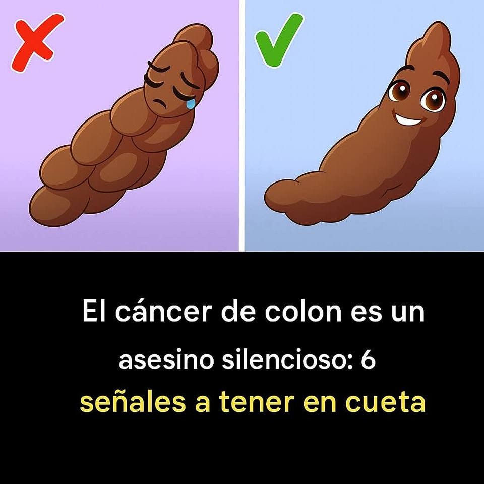 Cáncer de colon: señales a tener en cuenta