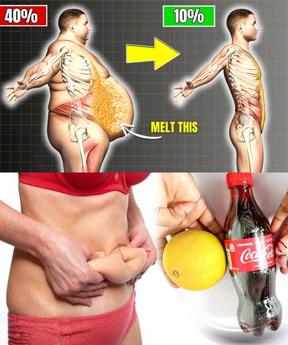 Grasa abdominal