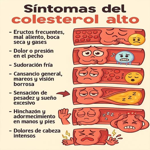 Síntomas del colesterol alto
