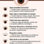Lo que tus ojos revelan sobre tu salud: ¡pon atención a las señales!