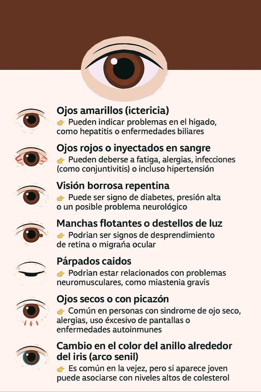 Infografía sobre los ojos y la salud