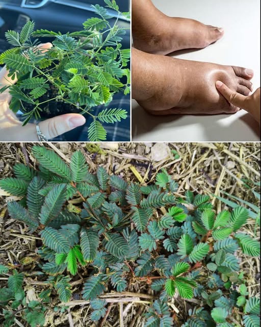 Collage de Mimosa pudica y pie inflamado