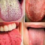Interpretación de la Lengua: ¿Qué Significan sus Variaciones y Cómo Mejorar tu Salud?
