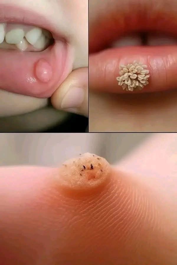 Afecciones cutáneas en los labios