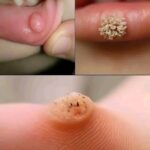 Primeros Signos de Enfermedades de la Piel y los Labios