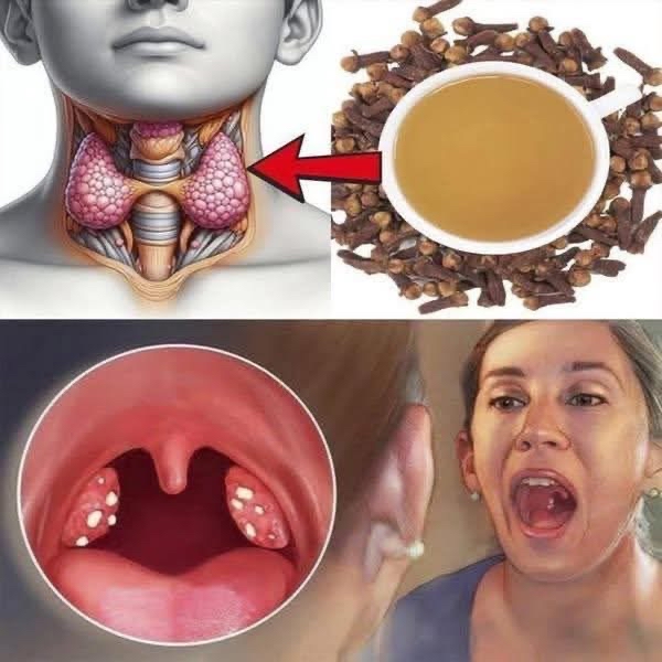 Clavo de Olor: Un Antibiótico Natural