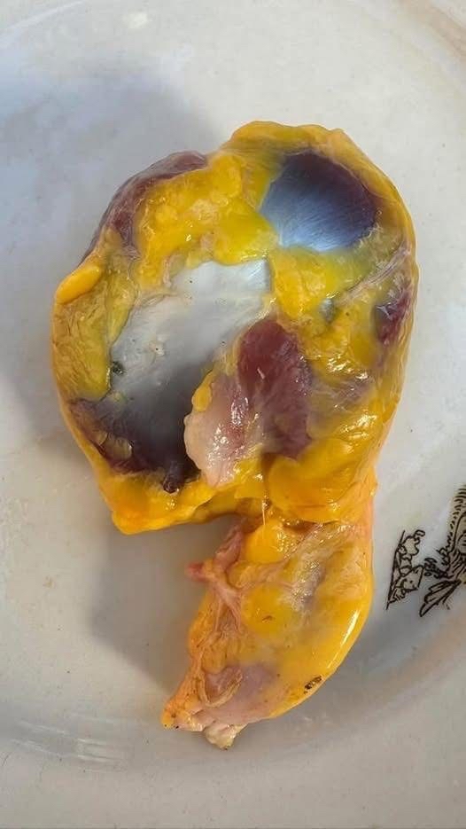 Molleja de pollo