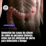 Síntomas de Cáncer de Colon en Jóvenes: Prevención y Cuidado Digestivo