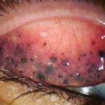 Las Consecuencias de Dormir con el Maquillaje: Cómo Cuidar tus Ojos y Párpados