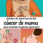 Detección Temprana del Cáncer de Mama: Síntomas que No Debes Ignorar