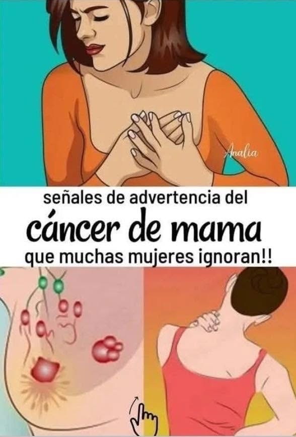 Síntomas de Cáncer de Mama