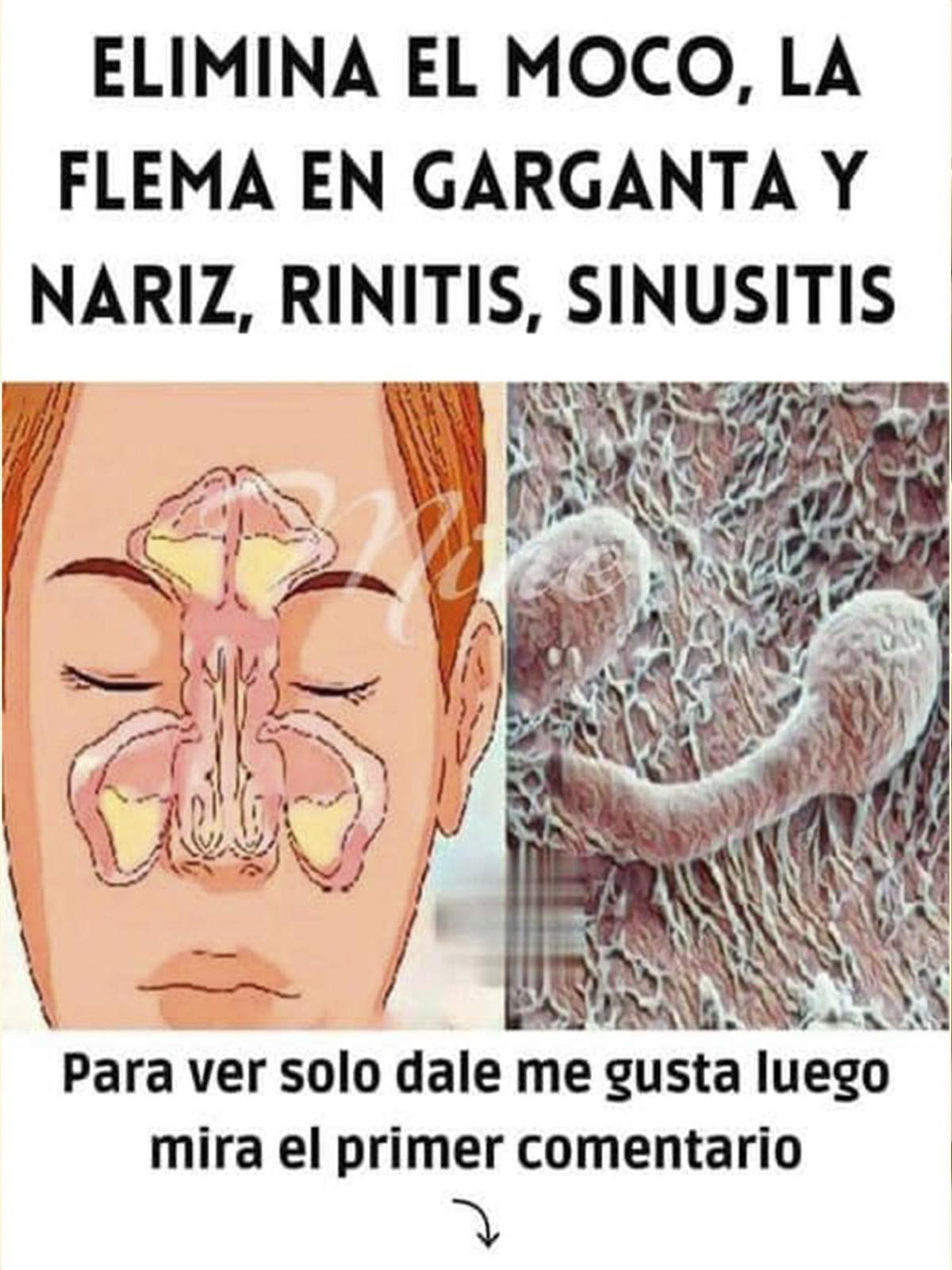 Sistema nasal y posibles invasores microscópicos