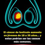 Cáncer de Testículo: Aumento en Jóvenes y Remedios Naturales