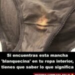 ¿Qué Significan las Manchas Blanquecinas en tu Ropa Interior?