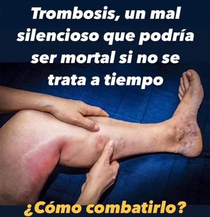 Pierna inflamada por trombosis