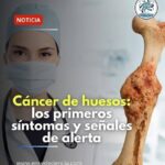 Cuidado: Reconoce los Síntomas Iniciales del Cáncer de Huesos