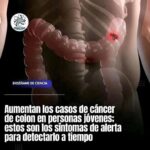 Conoce los Síntomas de Alerta del Cáncer de Colon en Jóvenes: Una Guía para la Detección Temprana