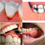 Signos Clave de que tu Salud Dental Está en Peligro: Cómo Identificar Problemas Comunes y Remedios Naturales