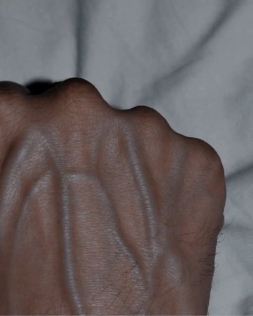 Venas visibles en la mano