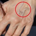 Visibilidad de las Venas: ¿Qué Significa y Cómo Cuidarlas?