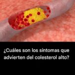10 Síntomas de Colesterol Alto que Nunca Debes Ignorar