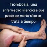 Las 6 Mejores Infusiones para Mantener Saludables Tus Arterias