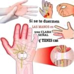 ¿Por qué se te Duermen las Manos? Causas, Síntomas y Remedios Caseros