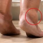 Cómo Reducir la Hinchazón en los Pies: Remedios Naturales y Consejos Prácticos