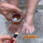 Rompe la Barrera de los Hongos: Remedios Caseros para Cuidar tus Pies